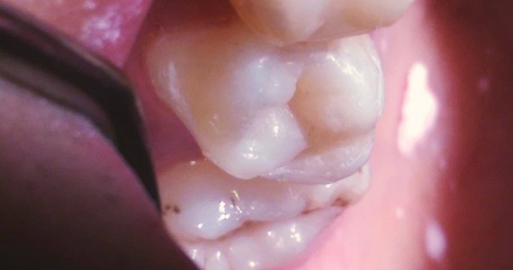Un caz Smile Dental Clinic