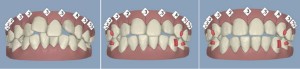 Invisalign_banner-02