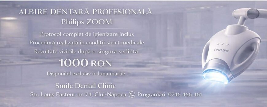 Zâmbește mai alb primăvara asta – albire dentară profesională cu reducere în luna Martie